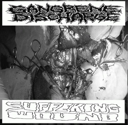 Gangrene Discharge : Gangrene Discharge - Suffering Wound